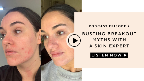 Podcast Episode 6 - Busting breakout myths with a skin expert