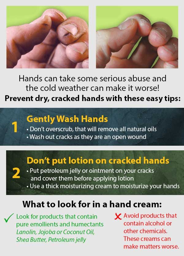 Hands can take some serious abuse and the cold weather can make it worse! Prevent dry, cracked hands with these easy tips:
