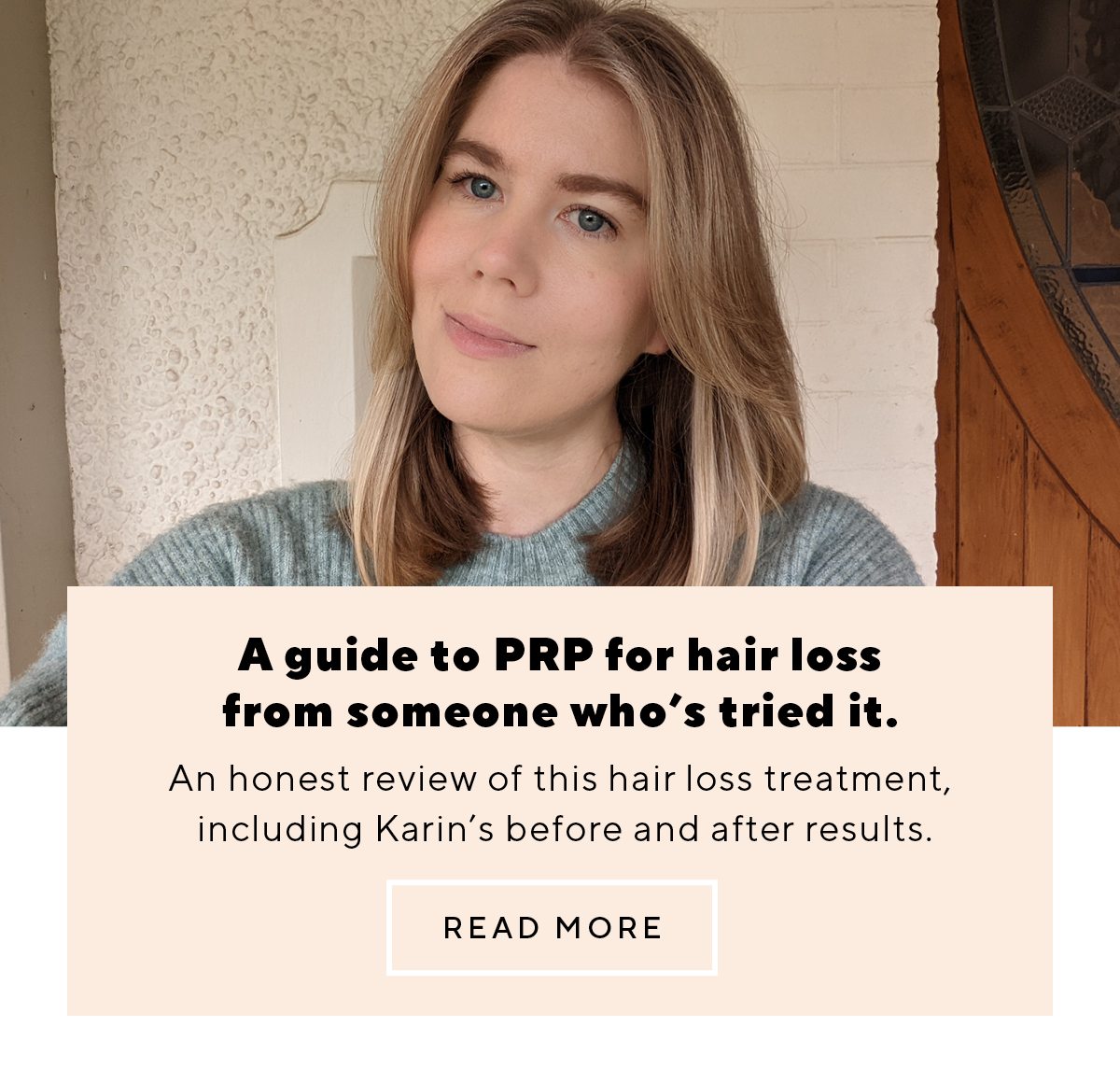 A guide to PRP for hair loss from someone who’s tried it.