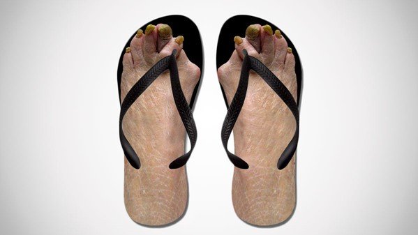 Ugly Feet Flip Flops