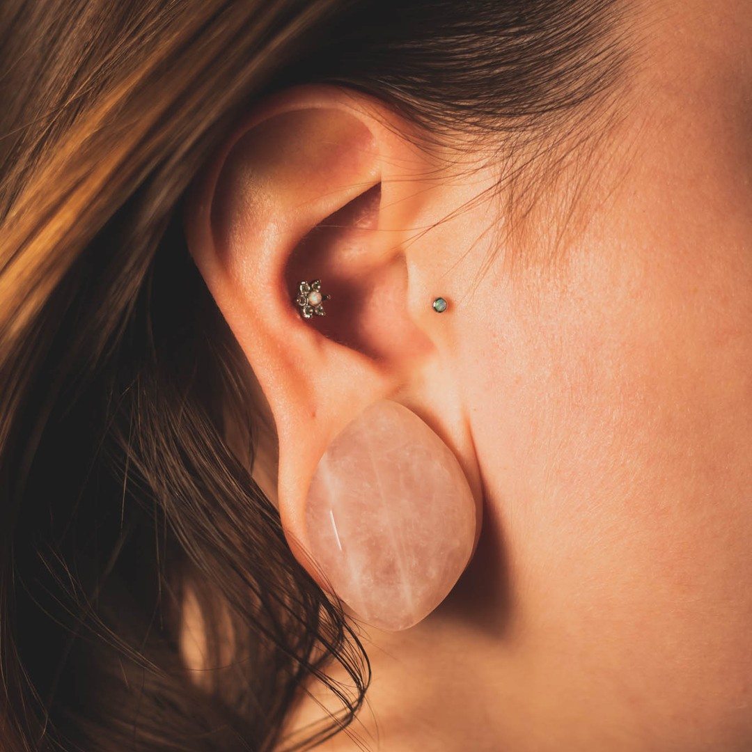 Can You Shrink Stretched Lobes?