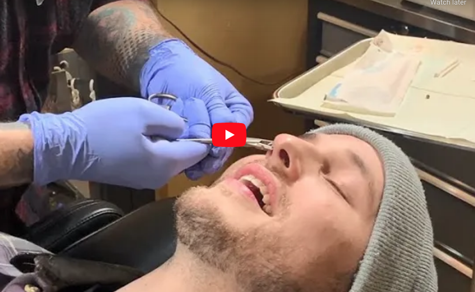 Piercing Experience: Nick's Nose Piercing