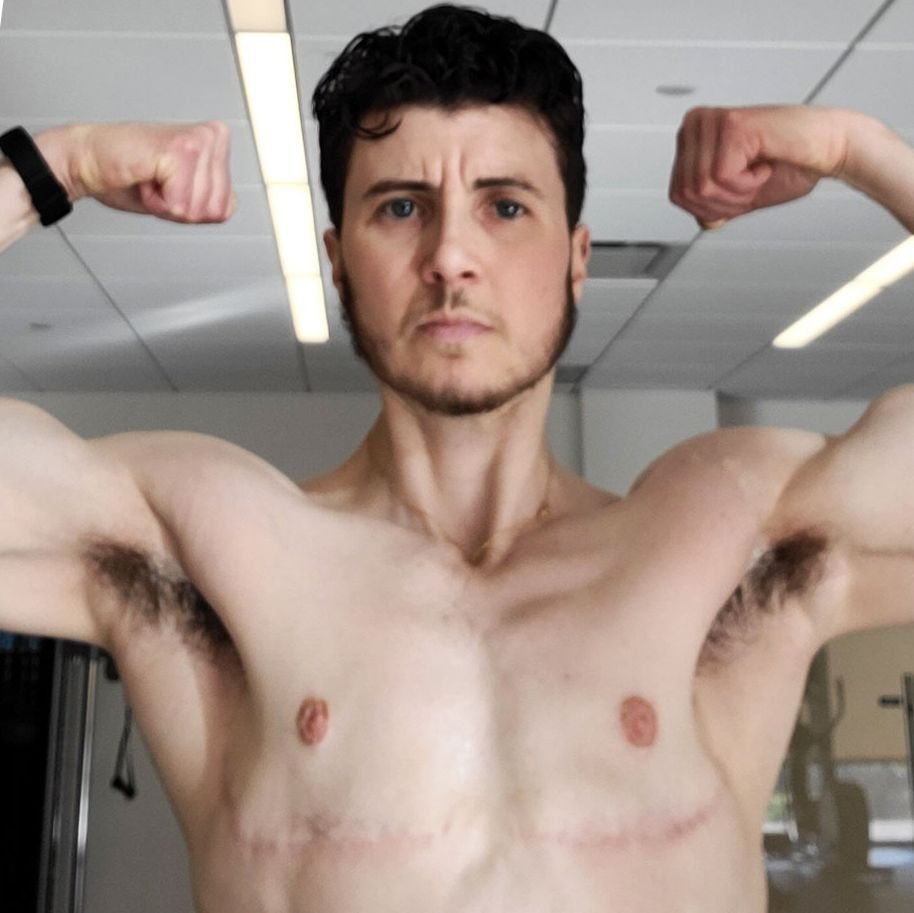 Testosterone Shots Made Me Feel Reborn