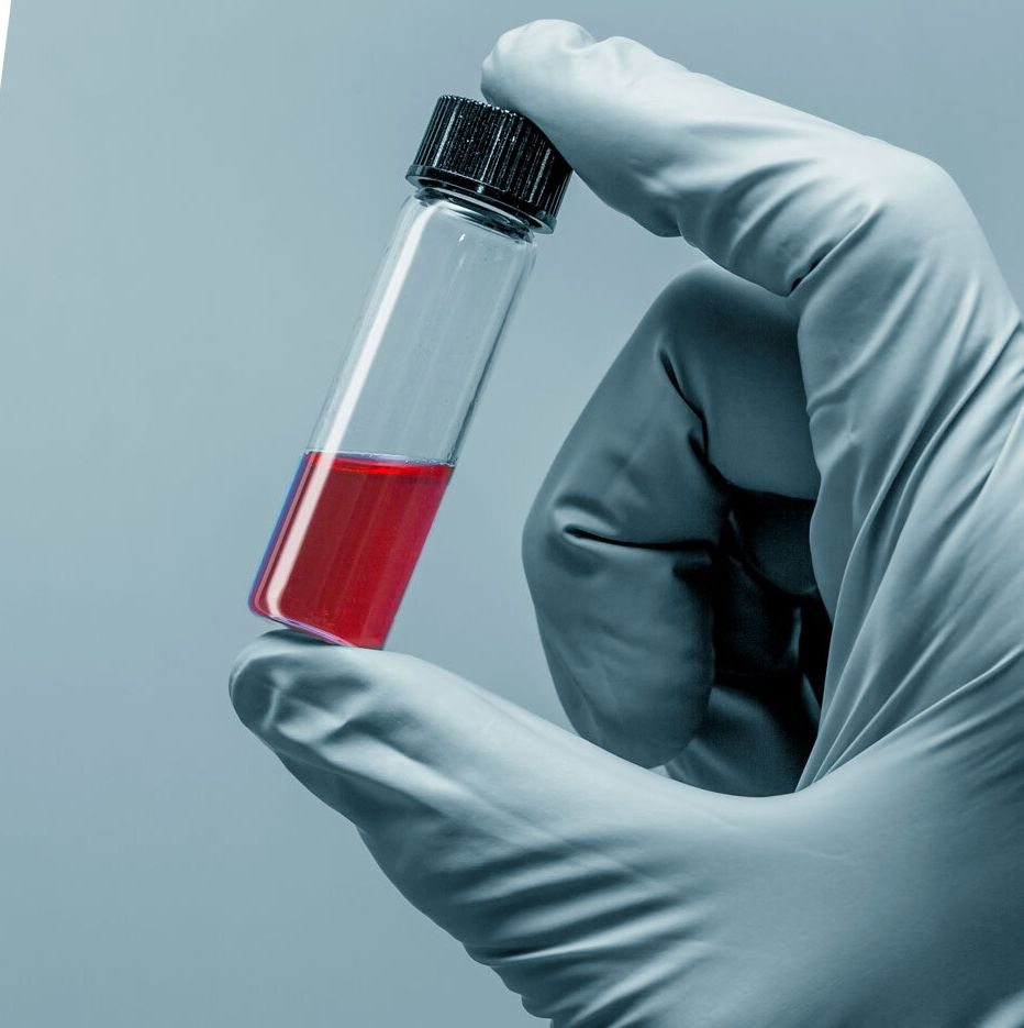 Are Your Testosterone Levels Normal?