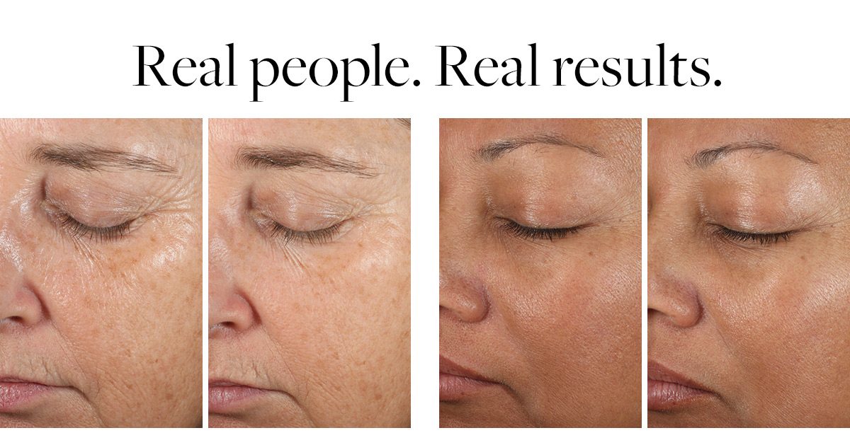 Real People - Real Results